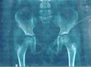 Figure 5. Findings on radiological examination