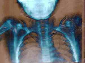 Figure 7. Findings on radiological examination