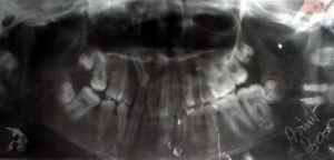 Figure 8. Findings on dental examination