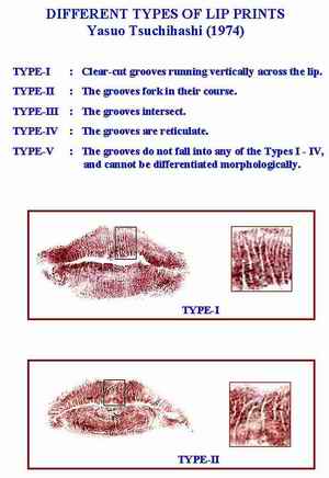 Figure 1. Types of Lip prints