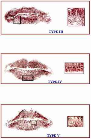 Figure 1. Types of Lip prints