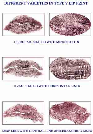 fig 4: Different Varieties Of Type V Lip Prints