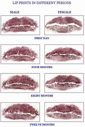 Fig 6: Lip Prints at Different Periods