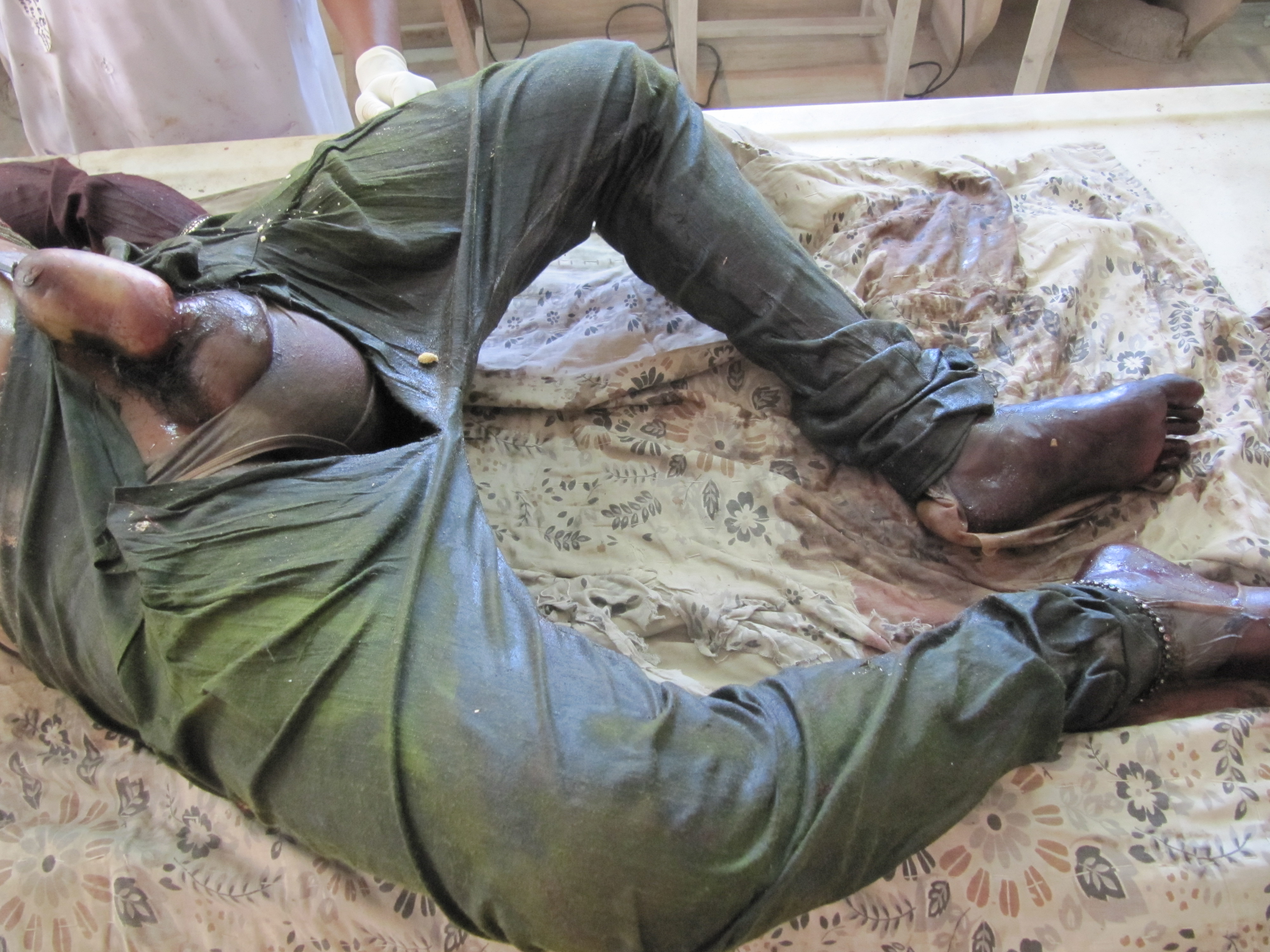 poster 7 - Transgender