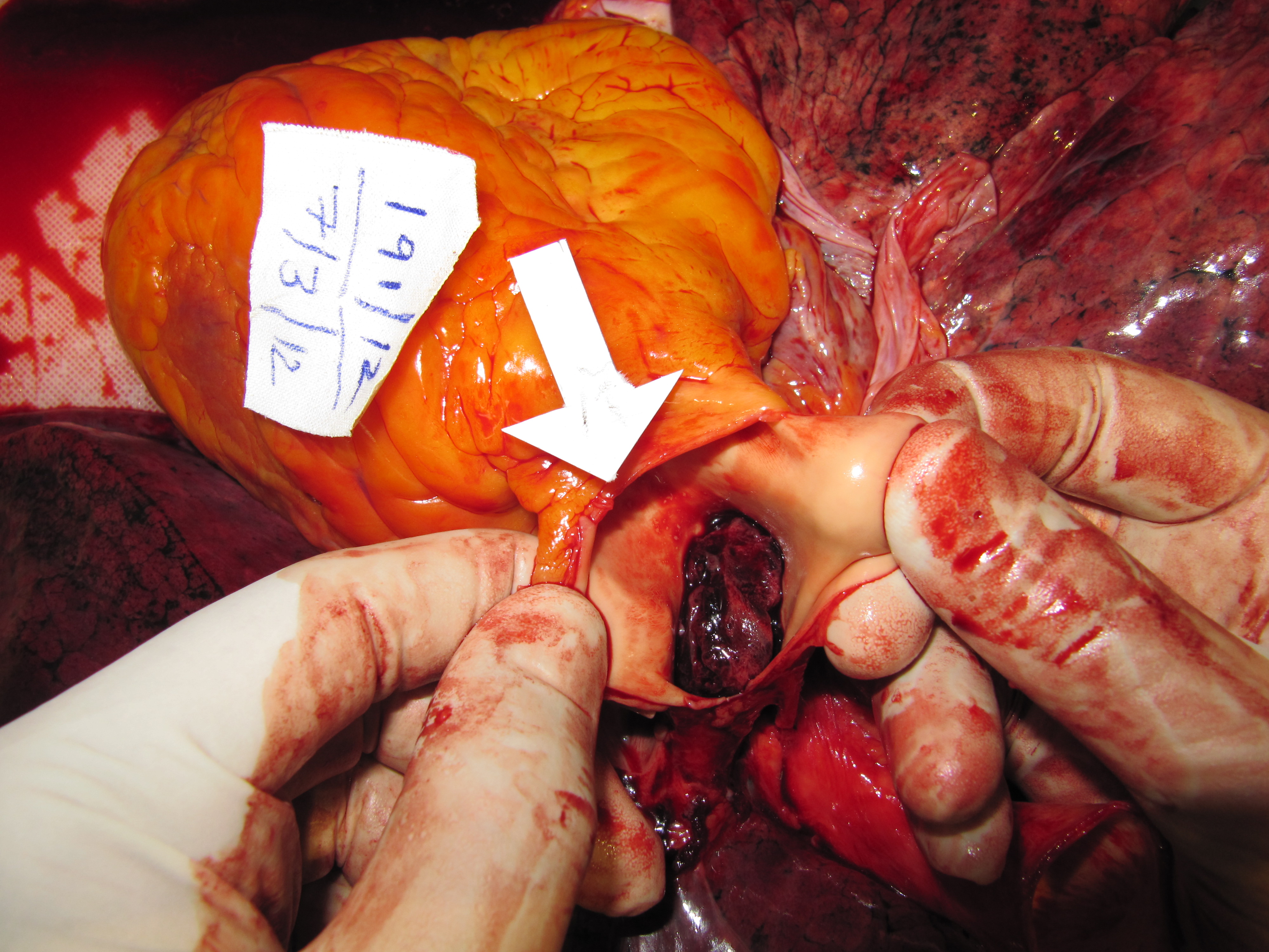 poster 8 - Transgender