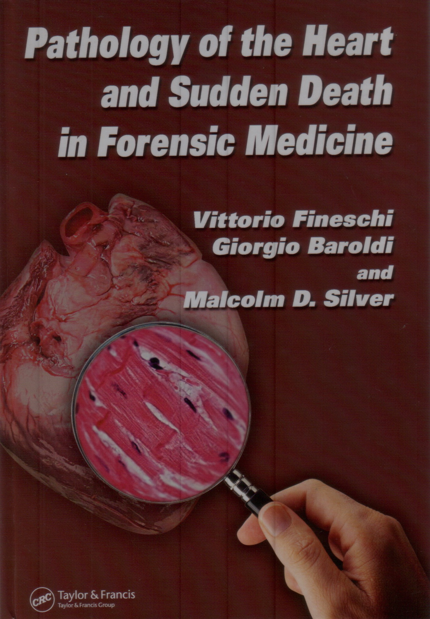 Pathology of the Heart and Sudden Death in Forensic Medicine, 1st Ed by Vittorio Fineschi, Giorgio Baroldi and Malcolm D. Silver